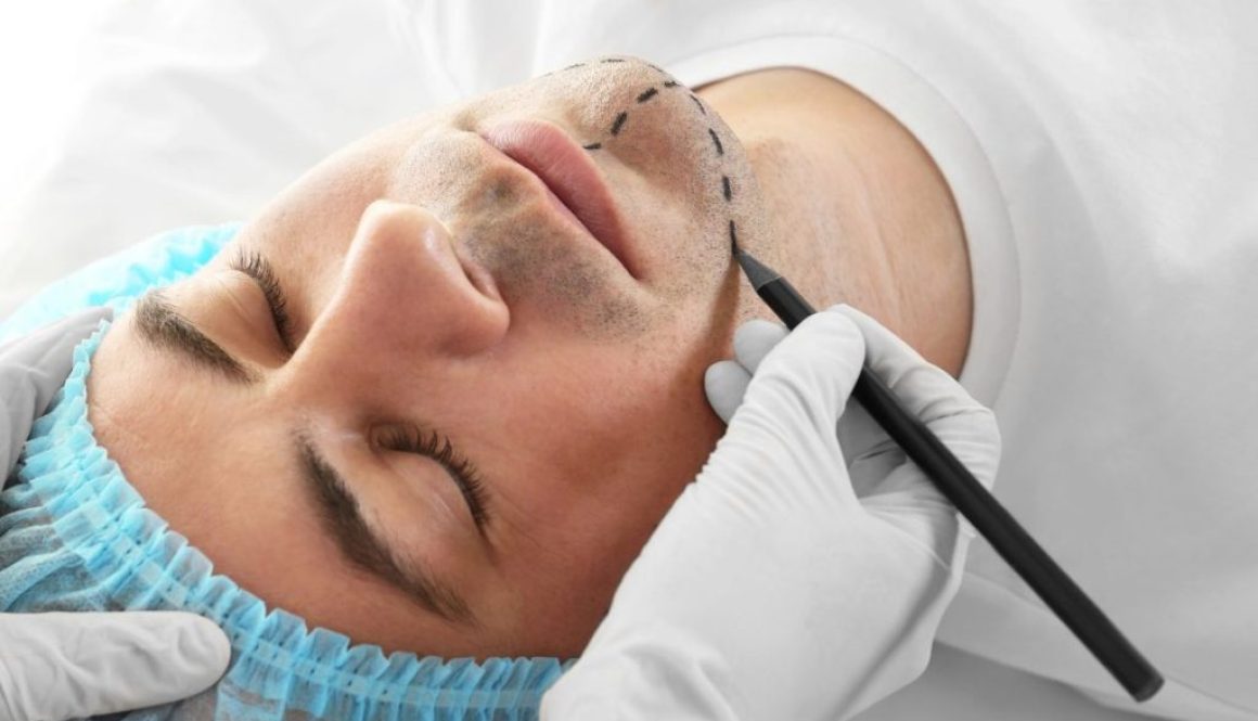 ashbury-cosmetics-drug-baron-used-cosmetic-surgery-in-an-attempt-to-hide-his-identity-blog