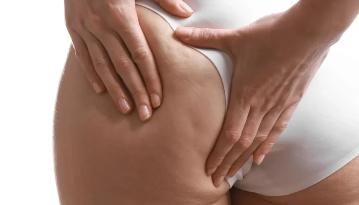 ashbury-cosmetics-cellulaze-procedure