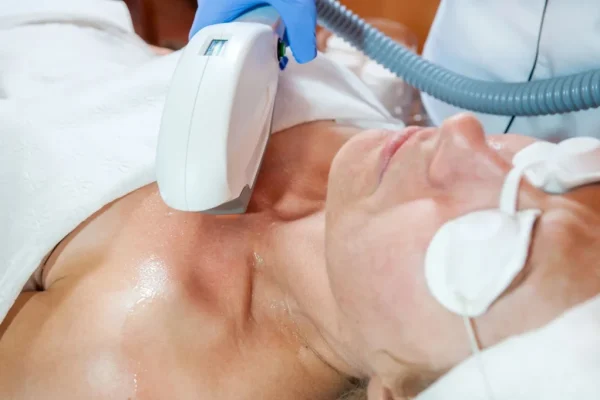 Laser Skin Treatments