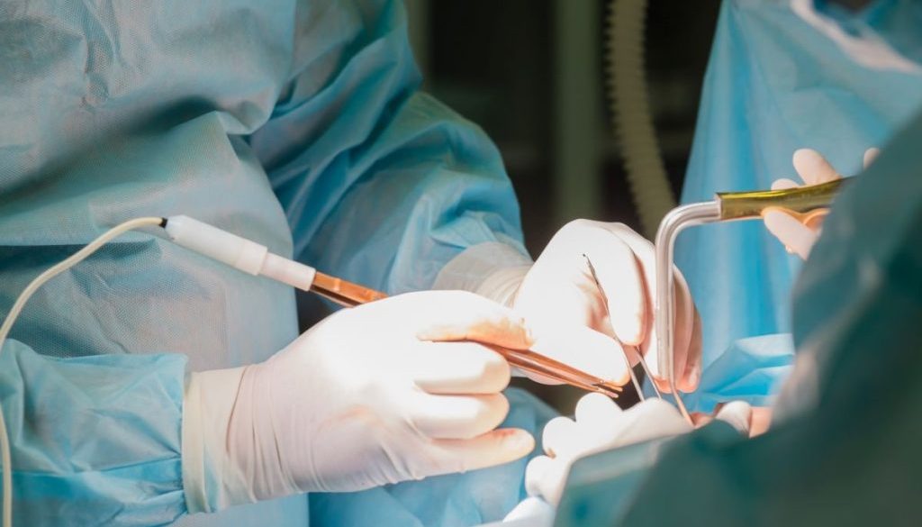 ashbury-cosmetics-liposuction-in-australia-what-you-need-to-know