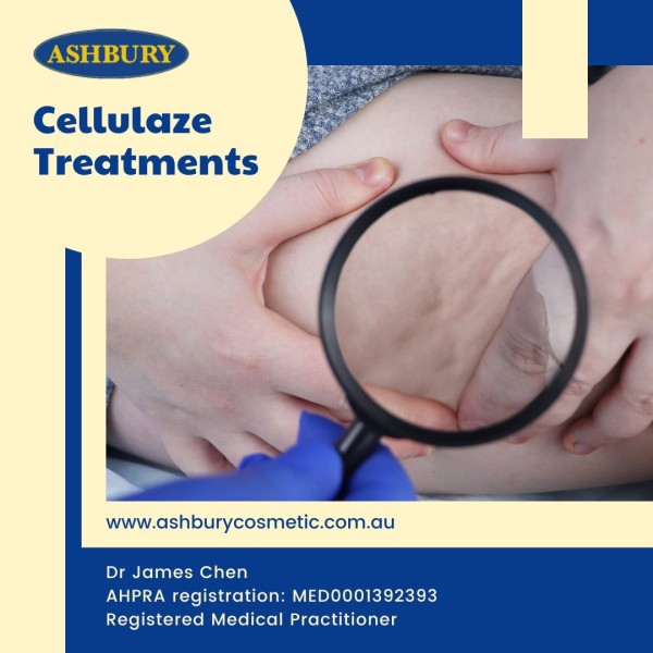 Looking for options to treat cellulite? Ashbury Cosmetic provides Cellulaze, a treatment that relies on targeting the inner dermal layers of the skin. Book your consultation now to determine if Cellulaze is the right procedure for you!**Disclaimer:** All surgical procedures carry risks. Before proceeding, you should seek a second opinion from an appropriately qualified health practitioner. The images/footage in this post are stock visuals and do not depict actual results from Ashbury Cosmetic procedures. For real client outcomes, please visit our website or contact us directly.
https://ashburycosmetic.com.au/cosmetic-reference-risks/

ashbury skin cellulite cellulaze
https://ashburycosmetic.com.au/surgical/body/cellulaze-cellulite-treatment/