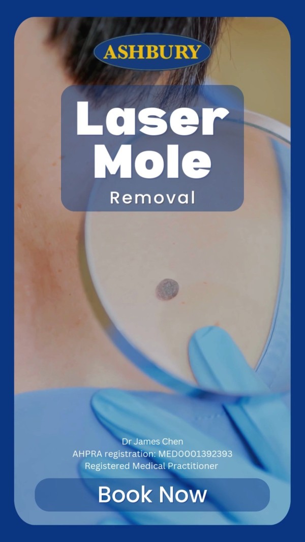 Ashbury Cosmetic provides laser mole and skin tag removal using precise, effective laser techniques. Book your consultation to speak with our doctors and see if this is the right treatment for you!**Disclaimer:** All procedures carry risks. Before proceeding, you should seek a second opinion from an appropriately qualified health practitioner. The images/footage in this post are stock visuals and do not depict actual results from Ashbury Cosmetic procedures. For real client outcomes, please visit our website or contact us directly.
https://ashburycosmetic.com.au/cosmetic-reference-risks/

ashbury skintag moleremoval
https://ashburycosmetic.com.au/non-surgical/skin/laser-skin-treatments/laser-mole-skin-tag-removal/